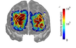 Image showing heatmap of activity in the front of the brain.